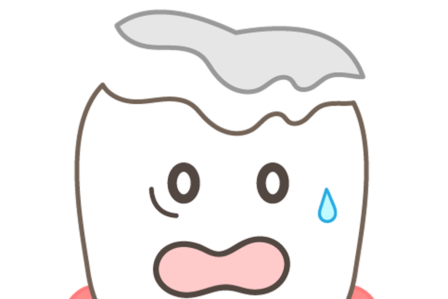 港南区丸山台（上永谷駅）の歯医者、上永谷丸山台デンタルオフィスの歯ぎしり、食いしばり